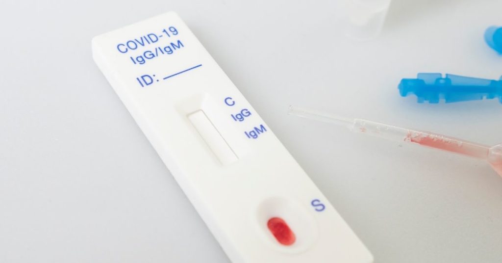 covid rapid antibody testing