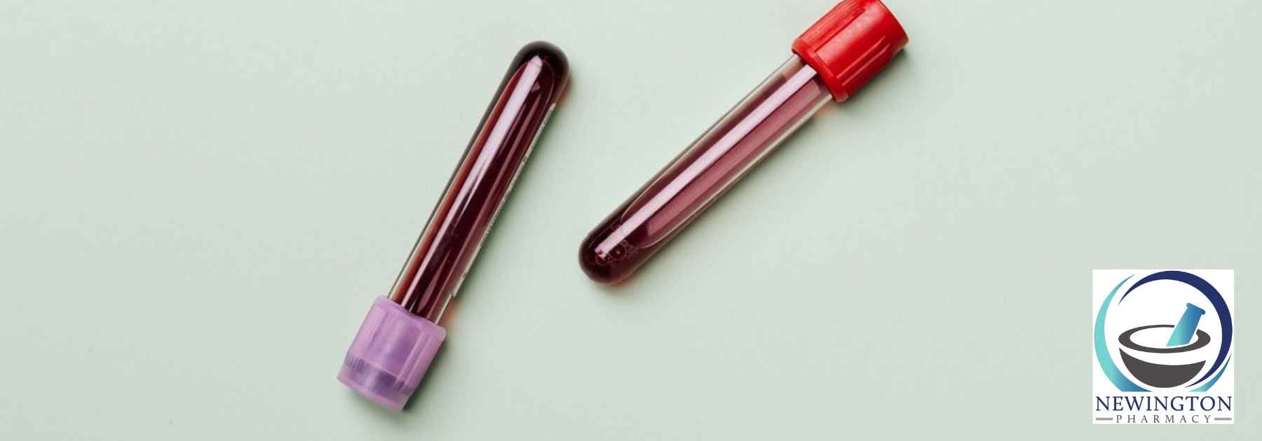 blood testing in Edinburgh
