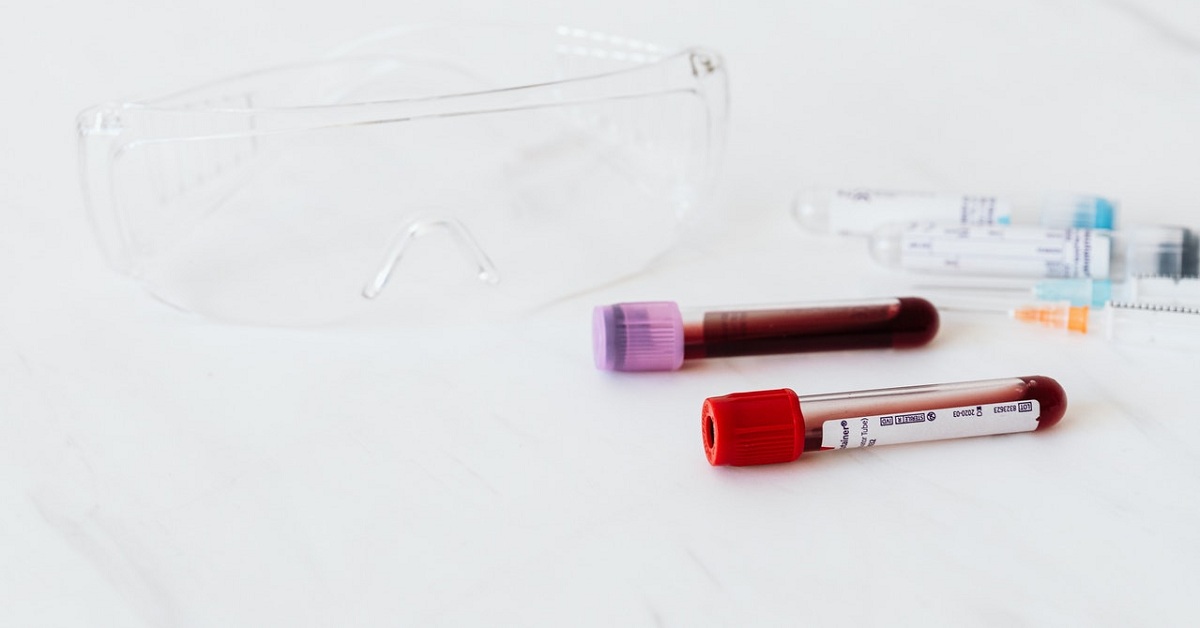 Allergy Testing Edinburgh