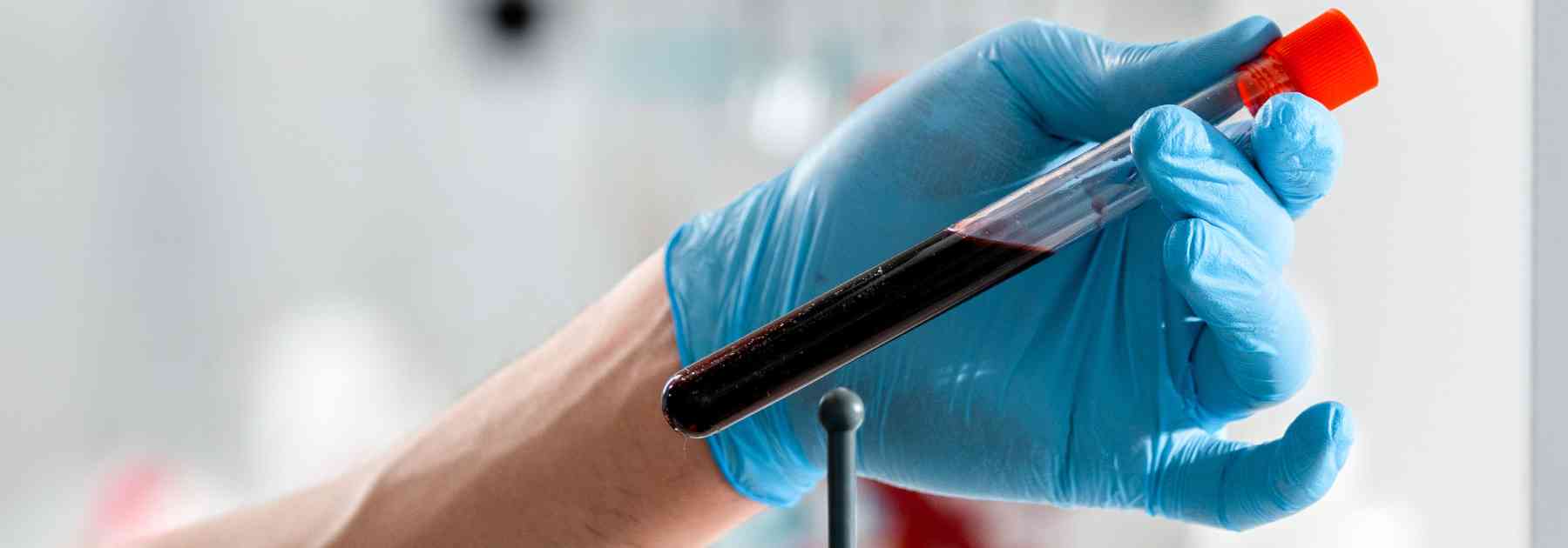 private allergy testing edinburgh