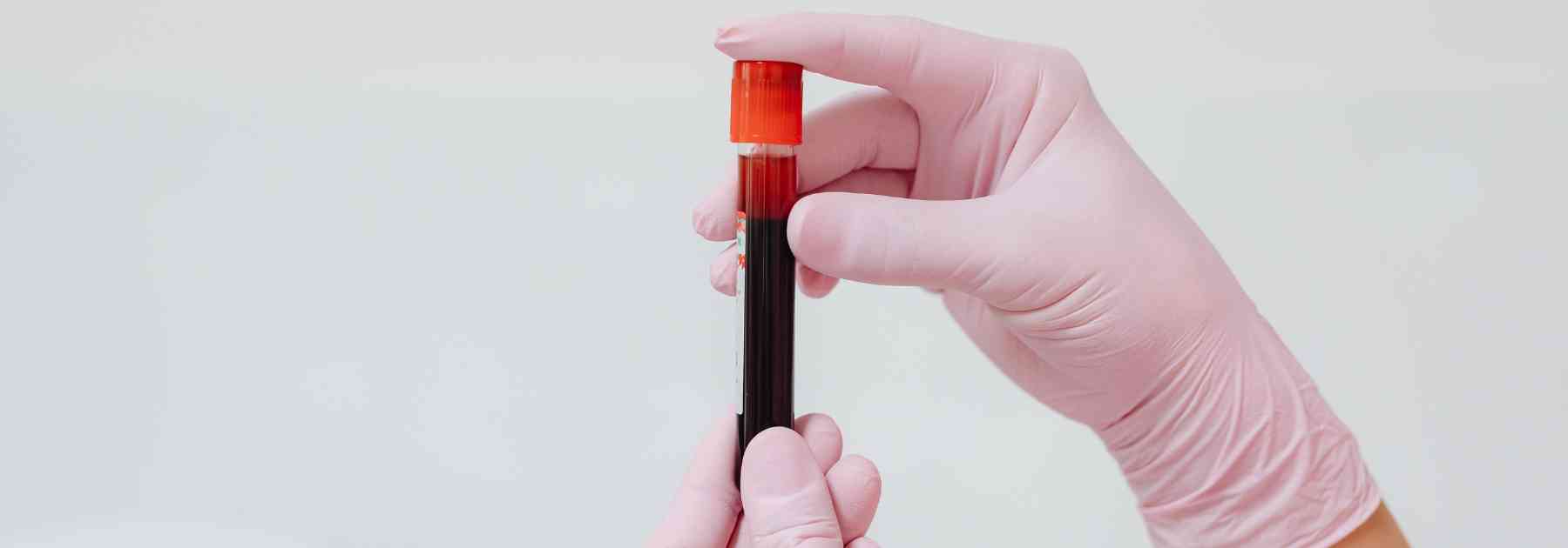 book a fertility test edinburgh