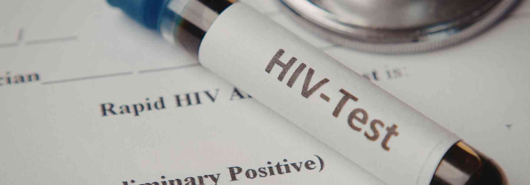hiv blood test