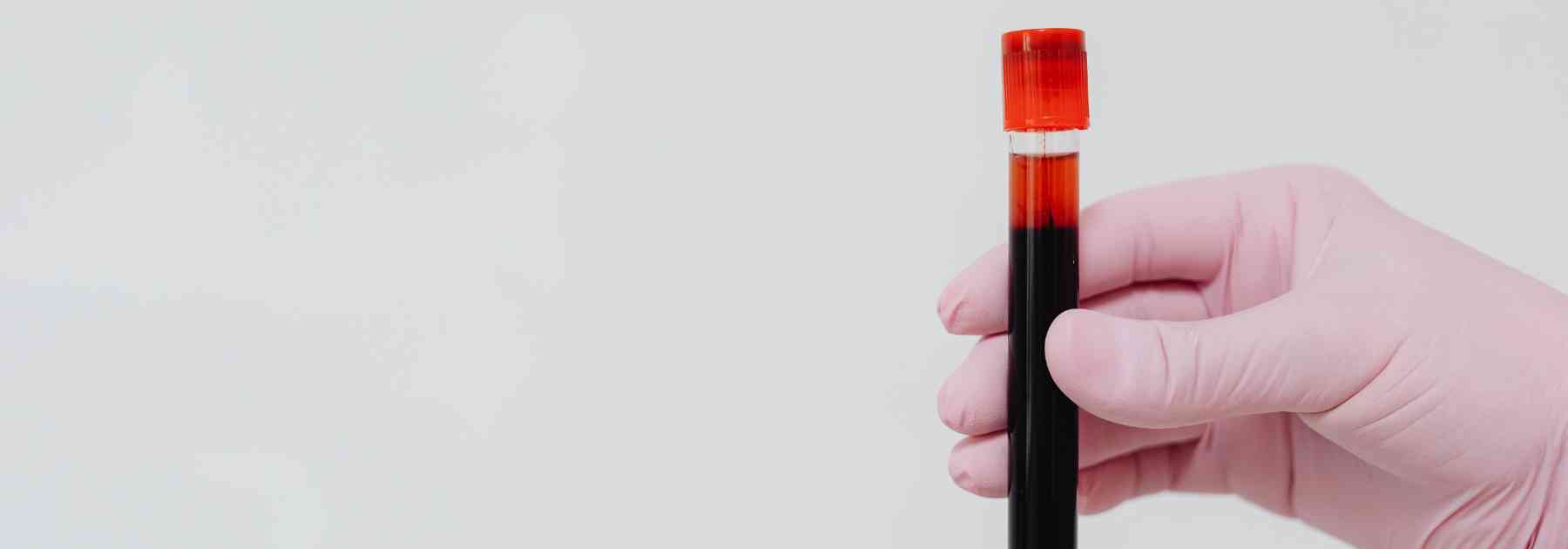 person wearing pink medical glove holding blood test
