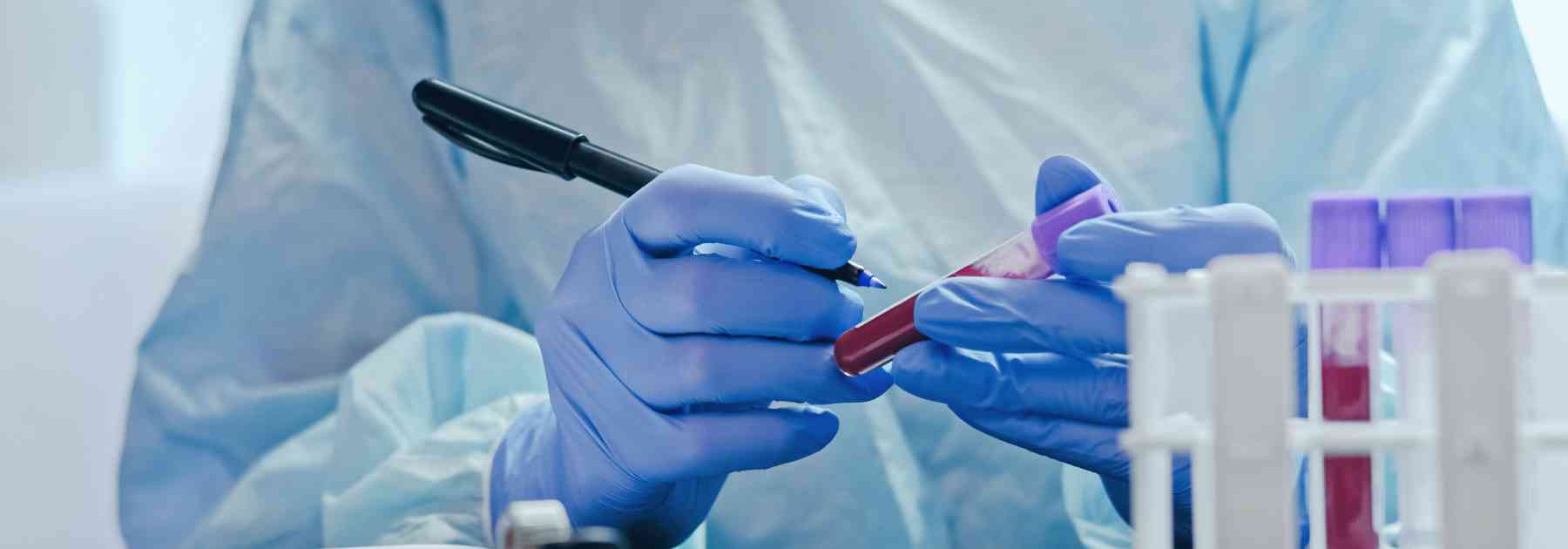 laboratory worker writing on blood test label