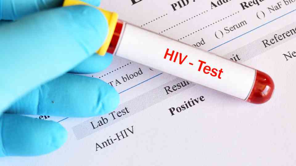 person holding hiv blood test