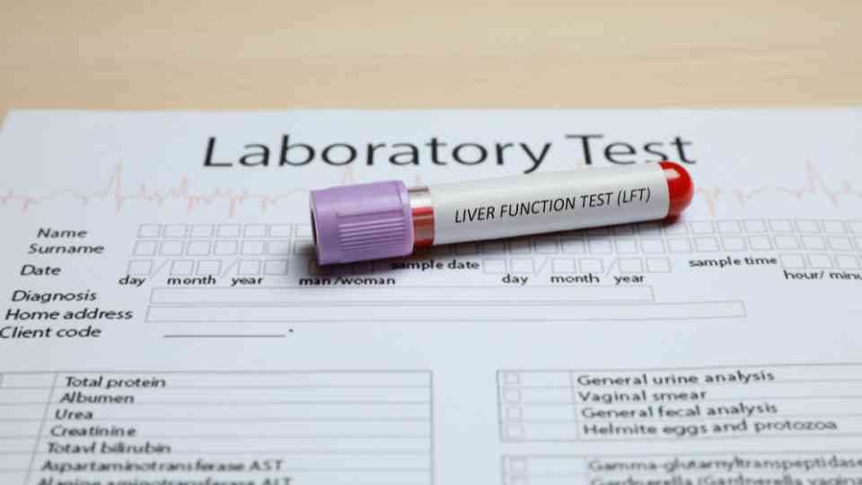 liver function blood test