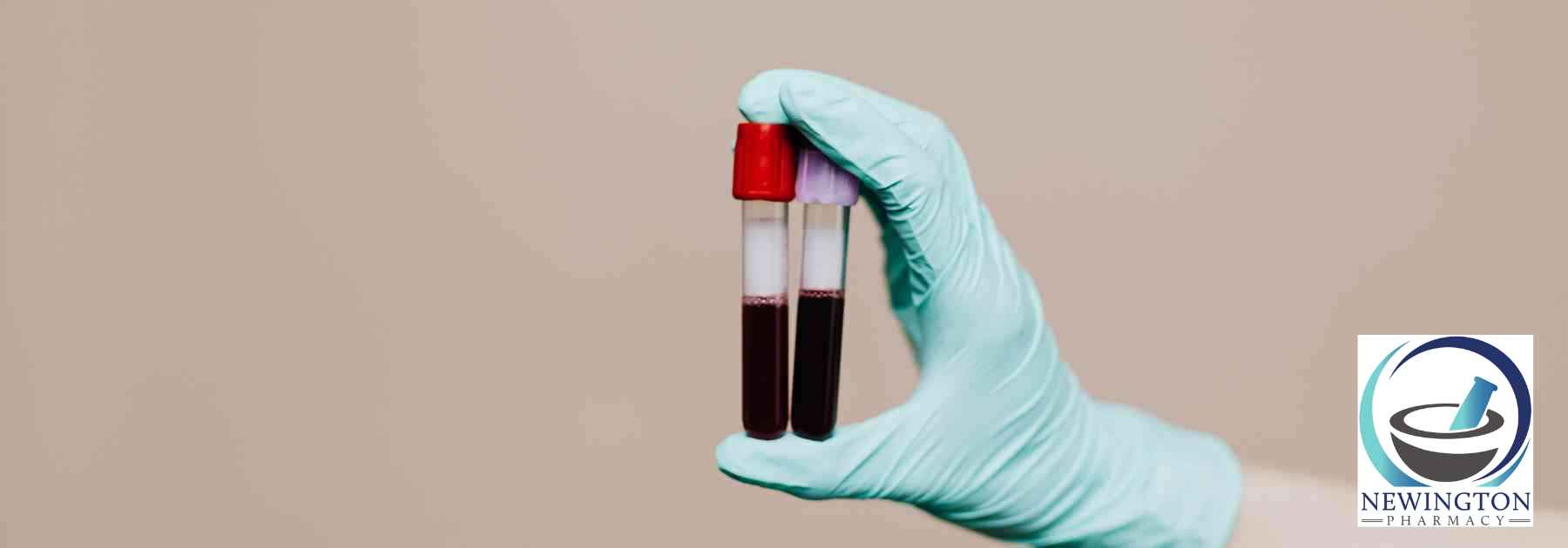 person wearing medical glove holding two blood tests