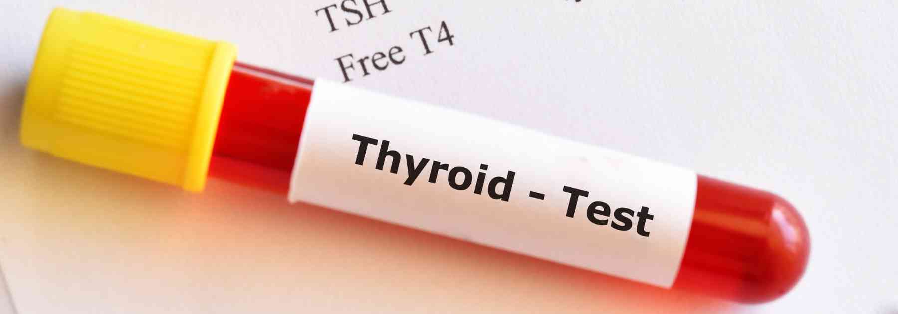 close-up of thyroid blood test