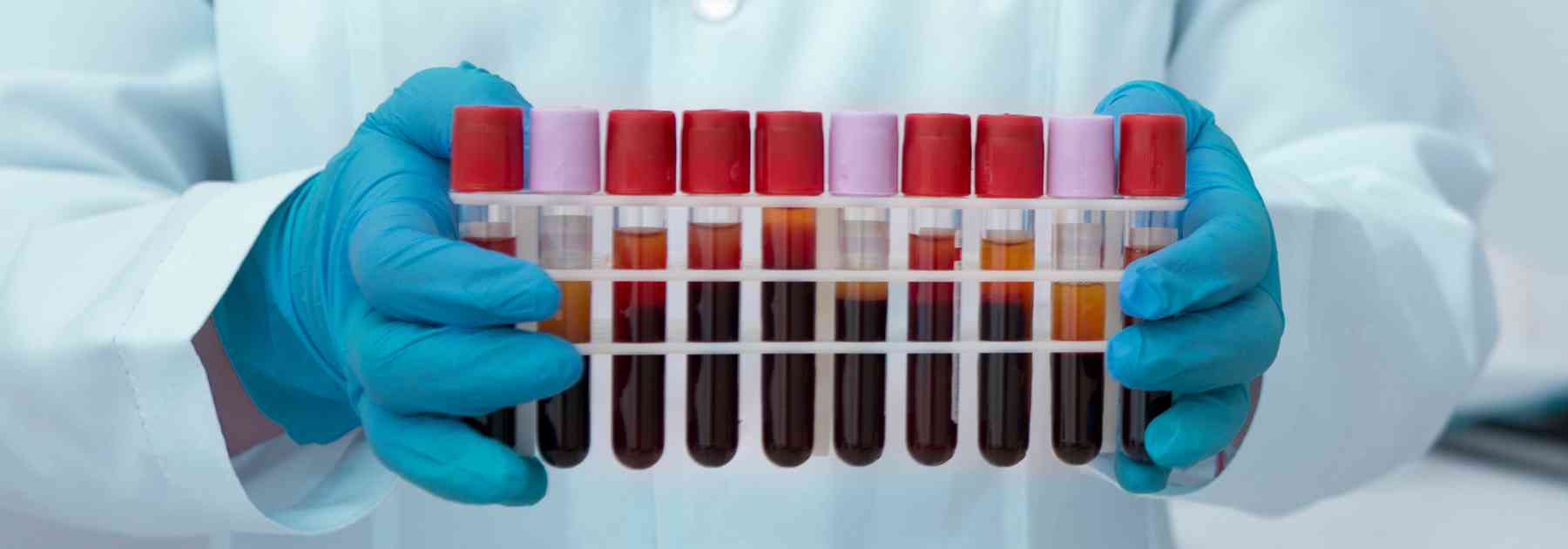 person in laboratory carrying blood tests