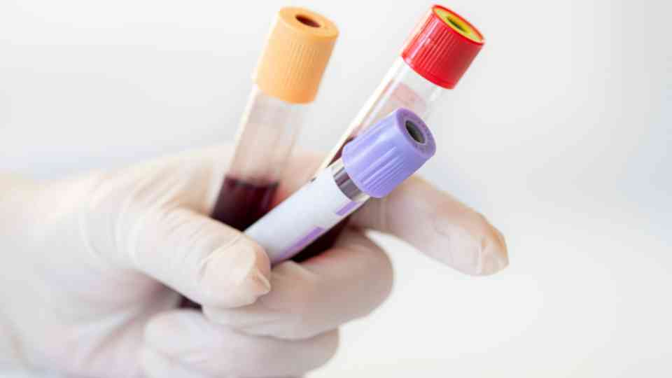 person wearing medical glove holding blood tests