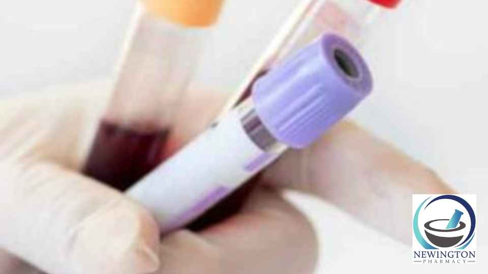 person wearing medical glove holding blood tests