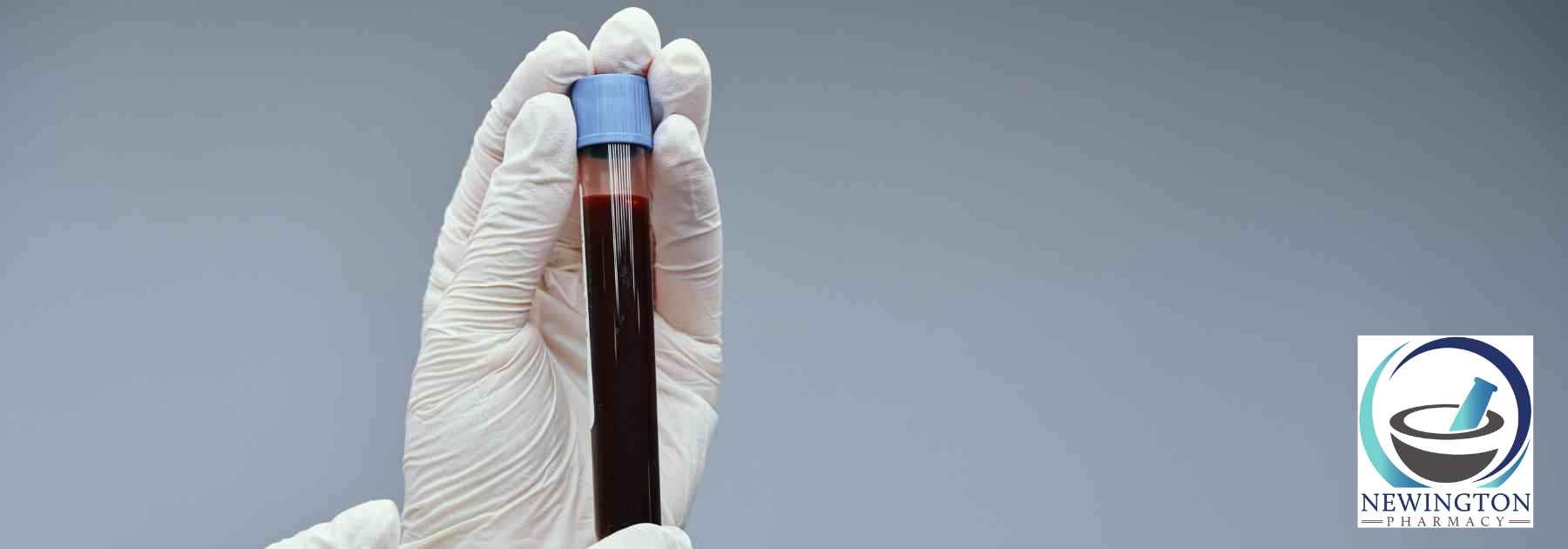 person wearing medical glove holding blood test