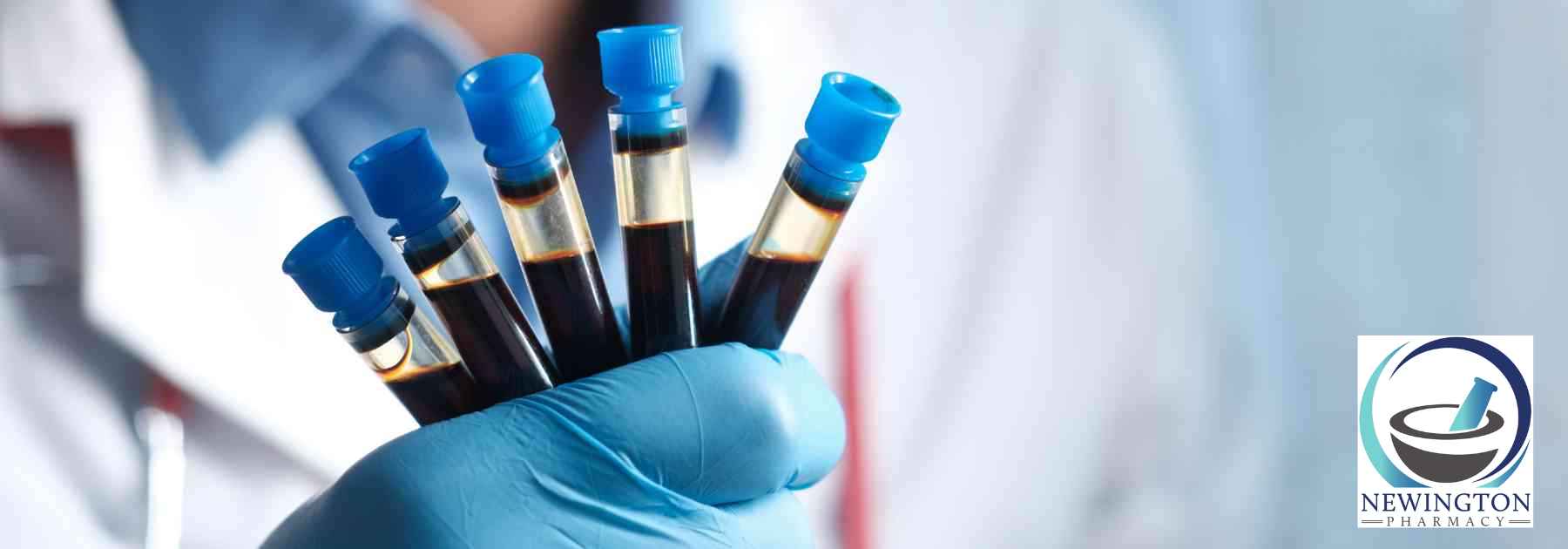 person wearing medical glove holding blood tests