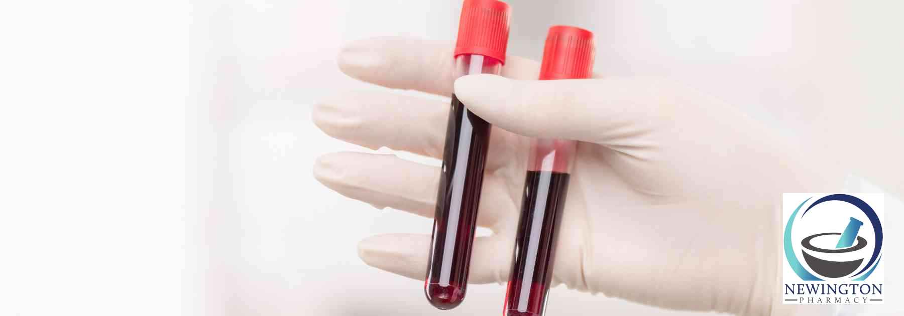 person wearing medical glove holding two blood tests