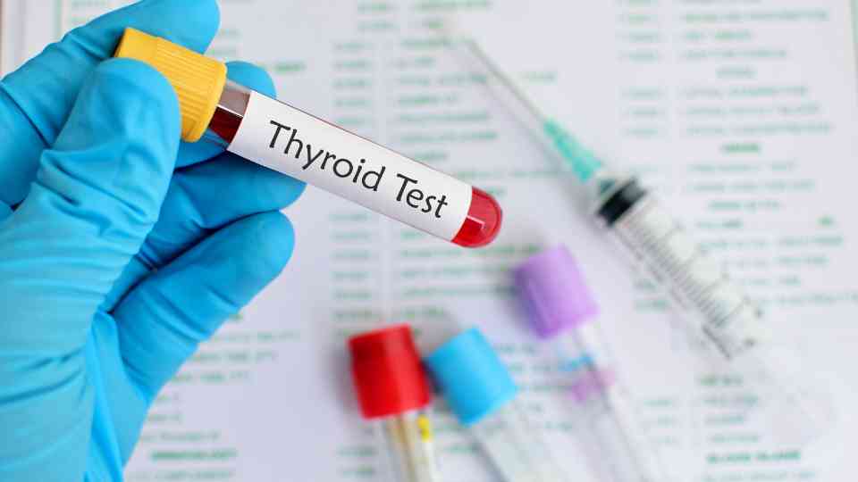 person in medical glove holding thyroid blood test
