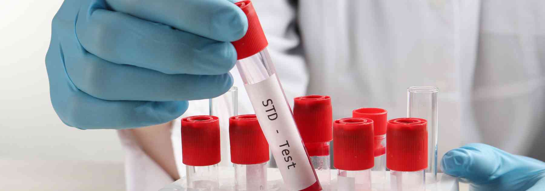 person in laboratory holding std blood test