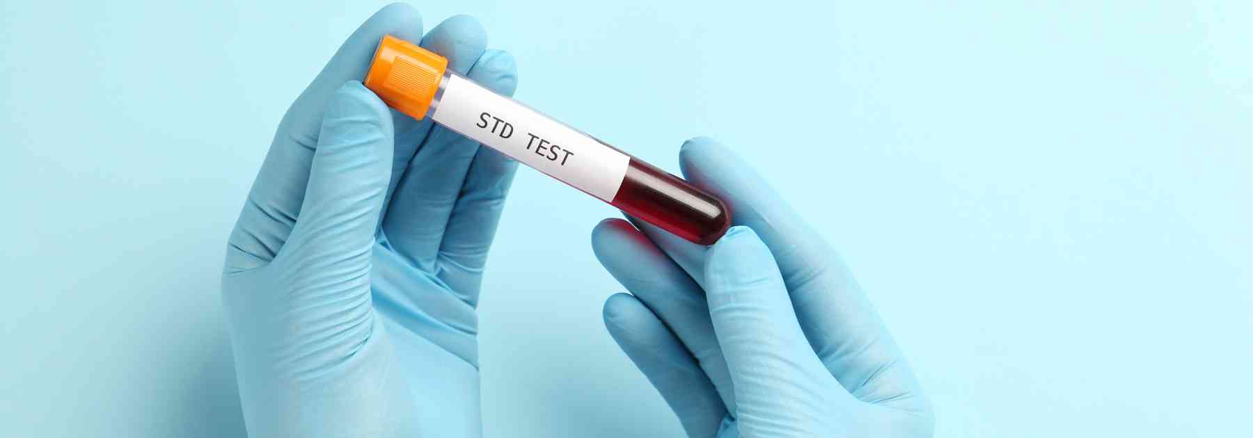 person wearing medical gloves holding std blood test on blue background