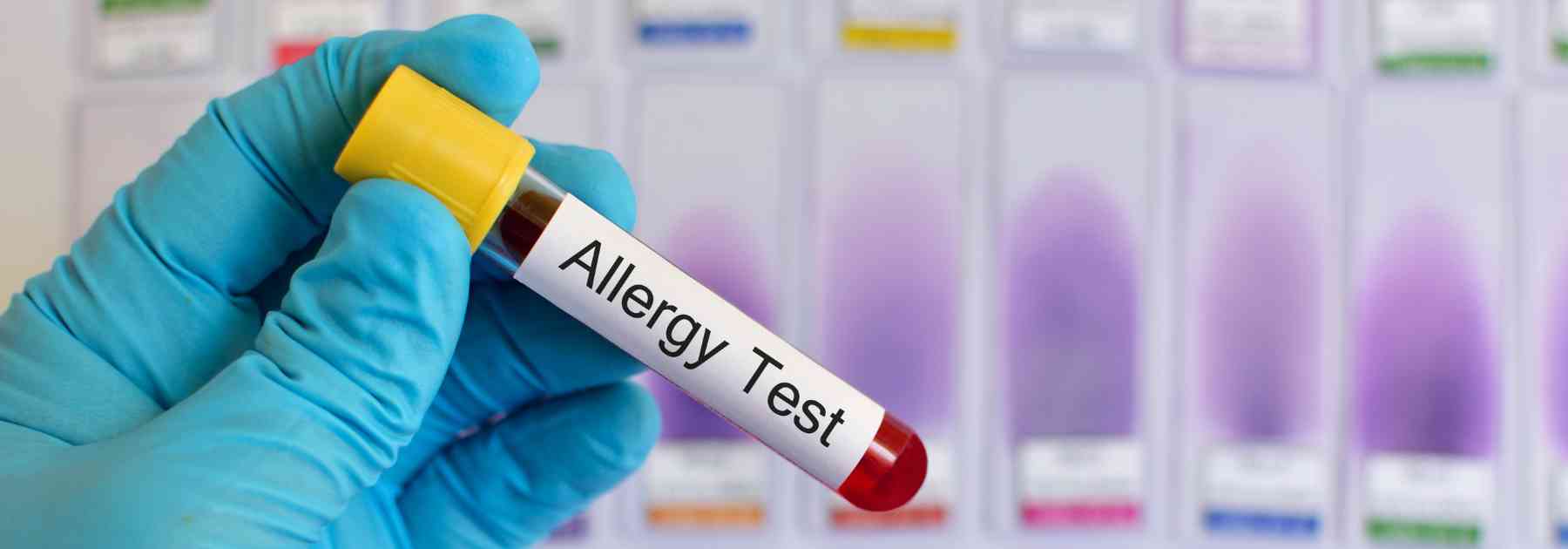 person wearing medical glove holding allergy blood test