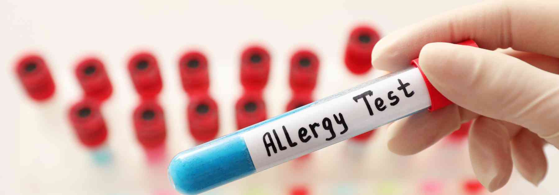 person wearing medical glove holding allergy blood test above other blood tests
