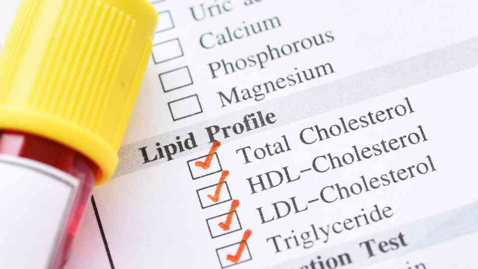 lipid profile blood test