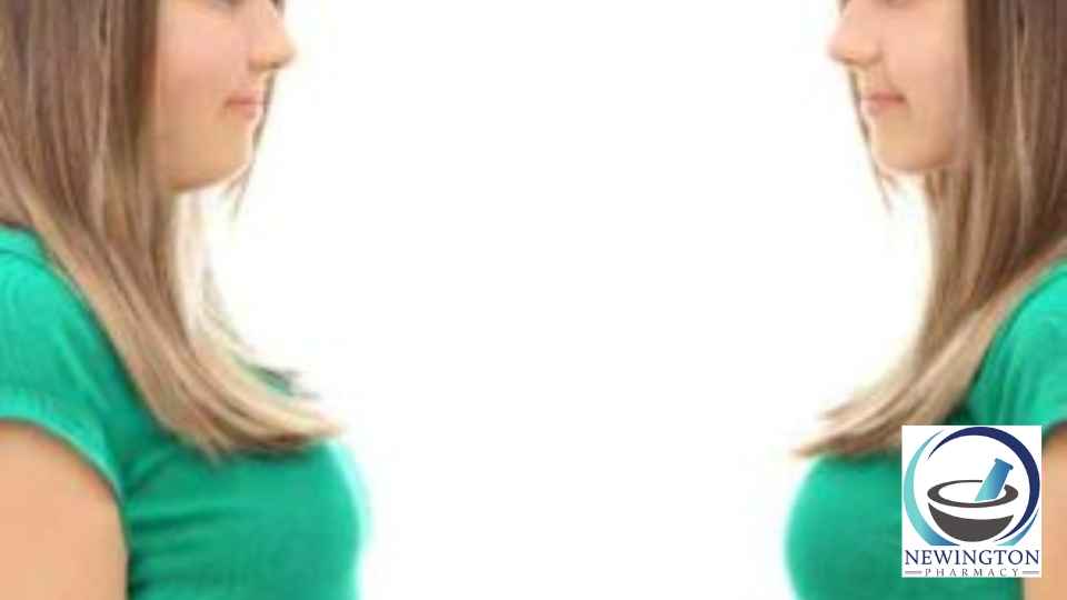 before and after pictures of female weight loss patient