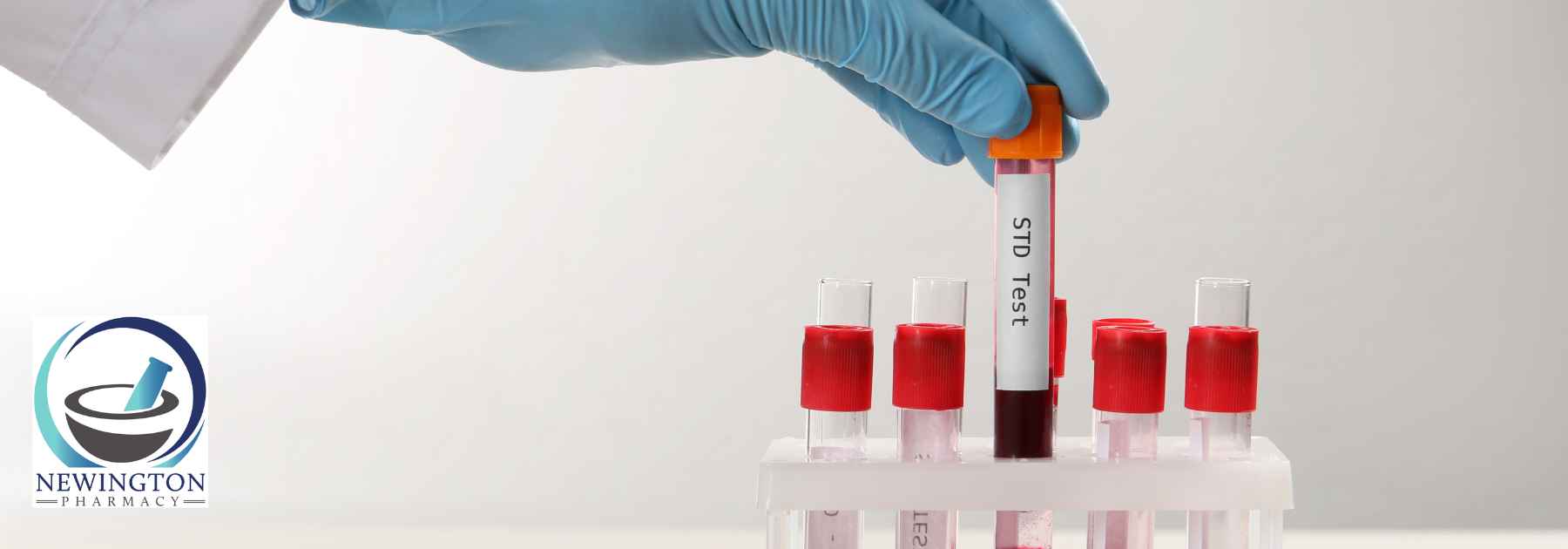 person wearing medical glove holding std blood test