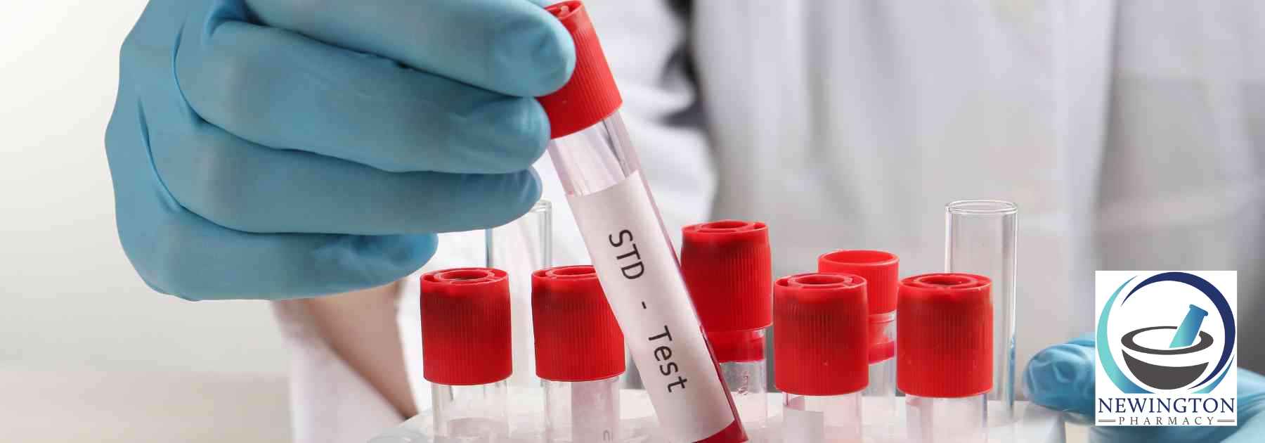 person in laboratory holding std blood test