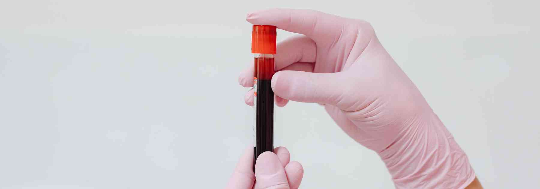 person wearing pink medical gloves holding blood test