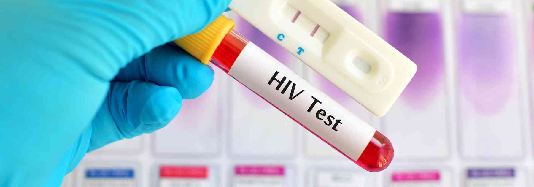 person wearing medical glove holding hiv blood test
