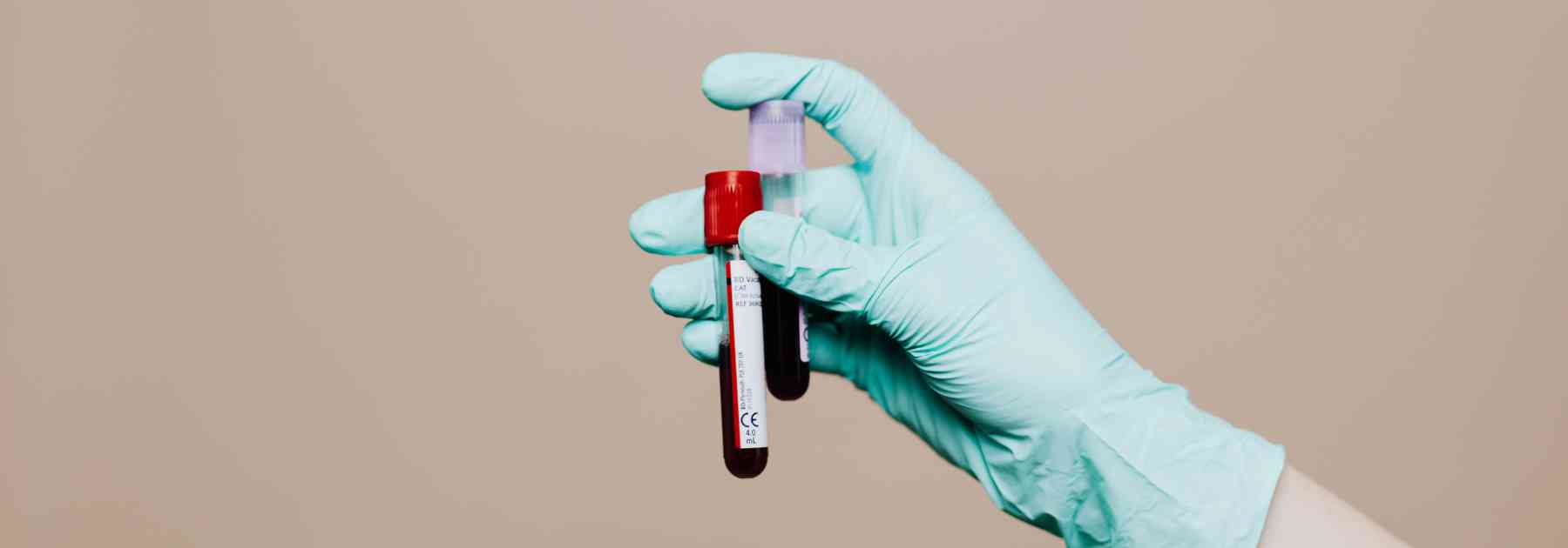 person wearing medical glove holding two blood tests on brown background