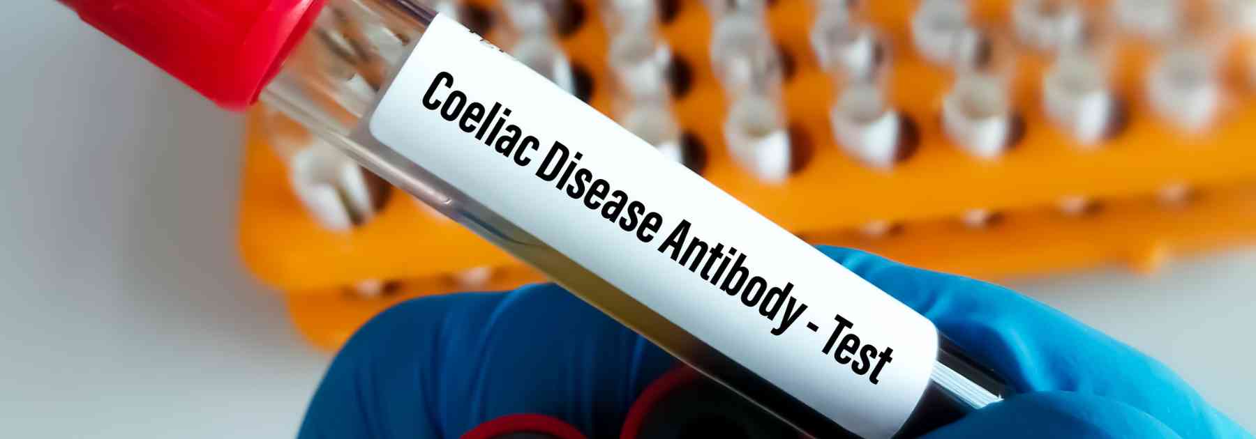 person in laboratory wearing medical glove holding blood test labelled coeliac disease antibody