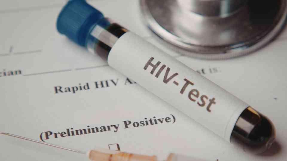 close-up of hiv blood test