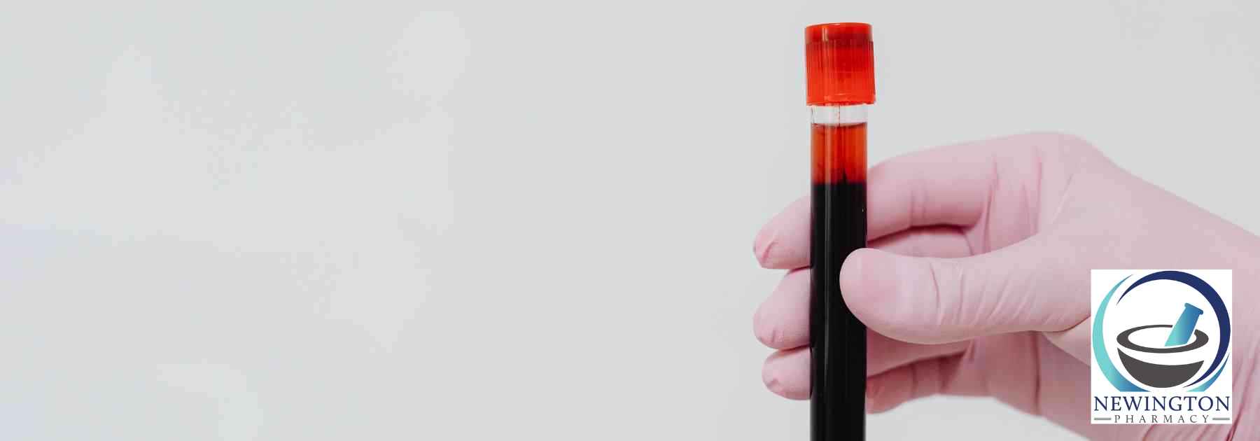 person wearing pink medical glove holding blood test