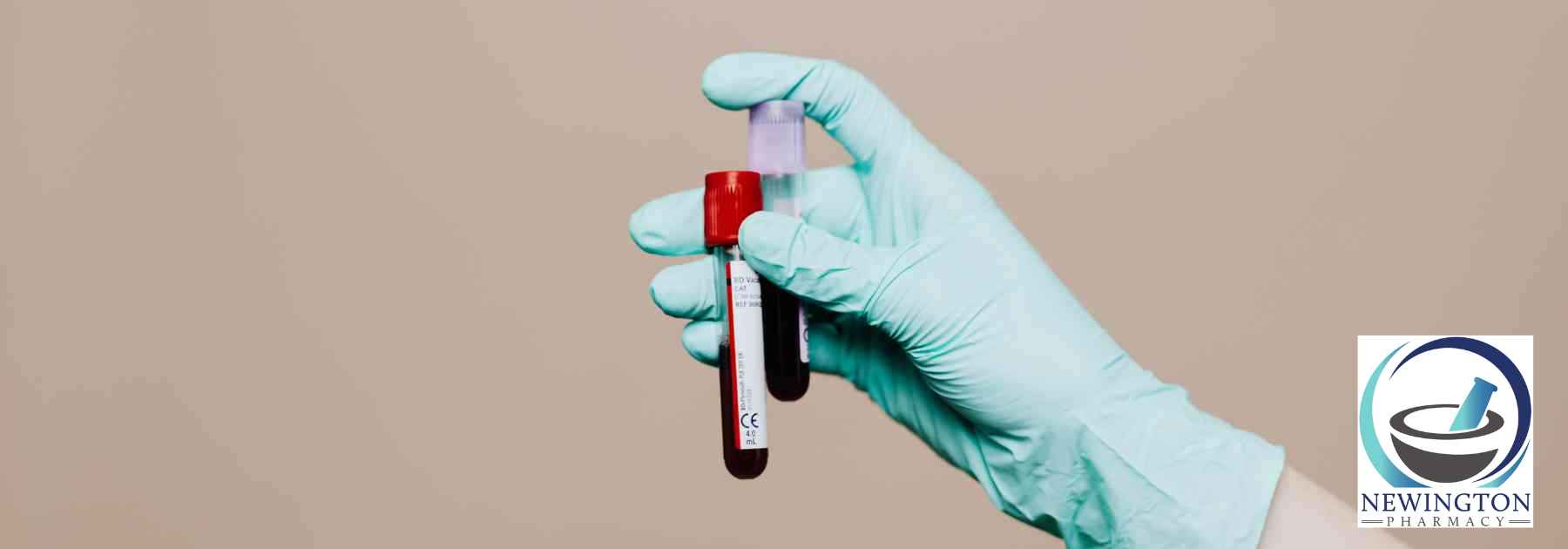 person wearing medical glove holding two blood tests on brown background
