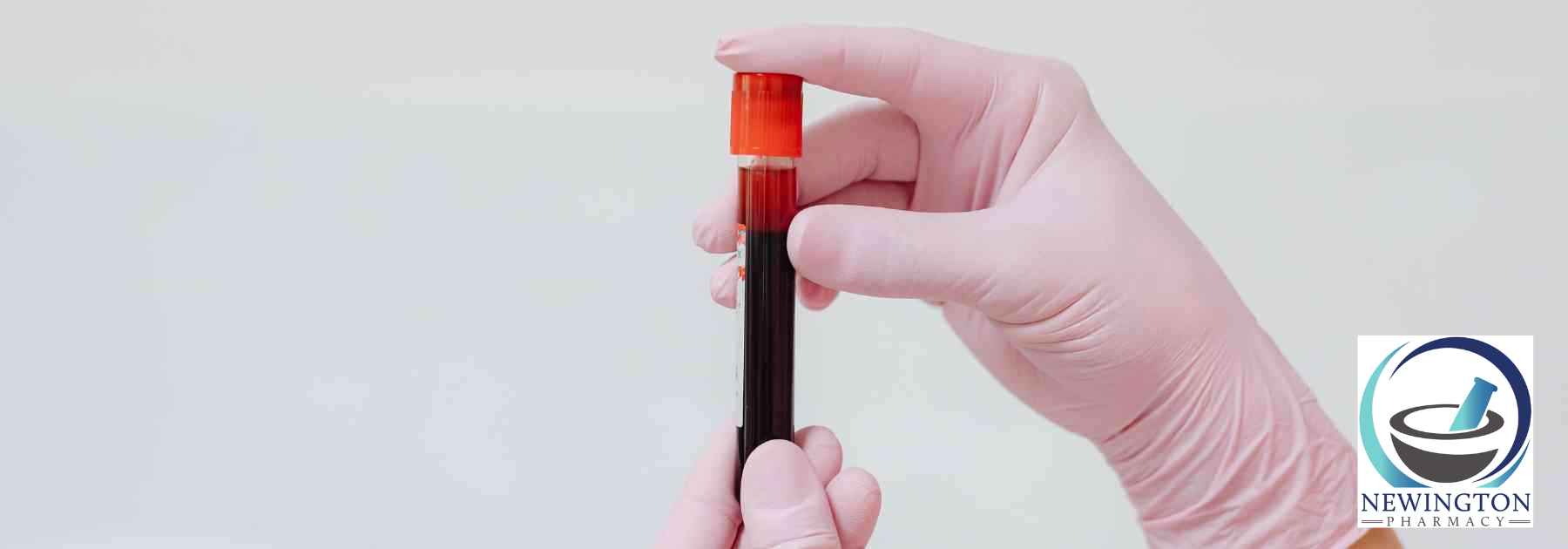 person wearing pink medical gloves holding blood test