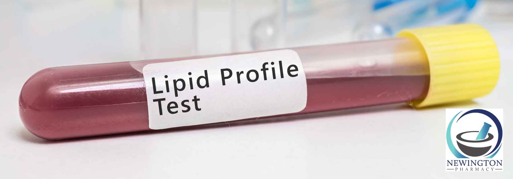 close-up of blood test labelled lipid profile test