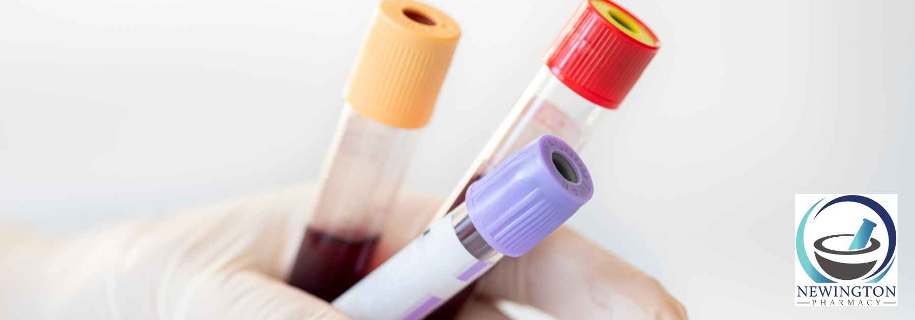 person wearing white medical glove holding three blood tests