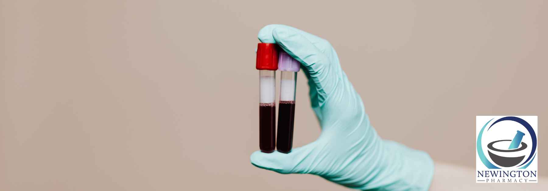 person wearing medical glove holding two blood tests on brown background