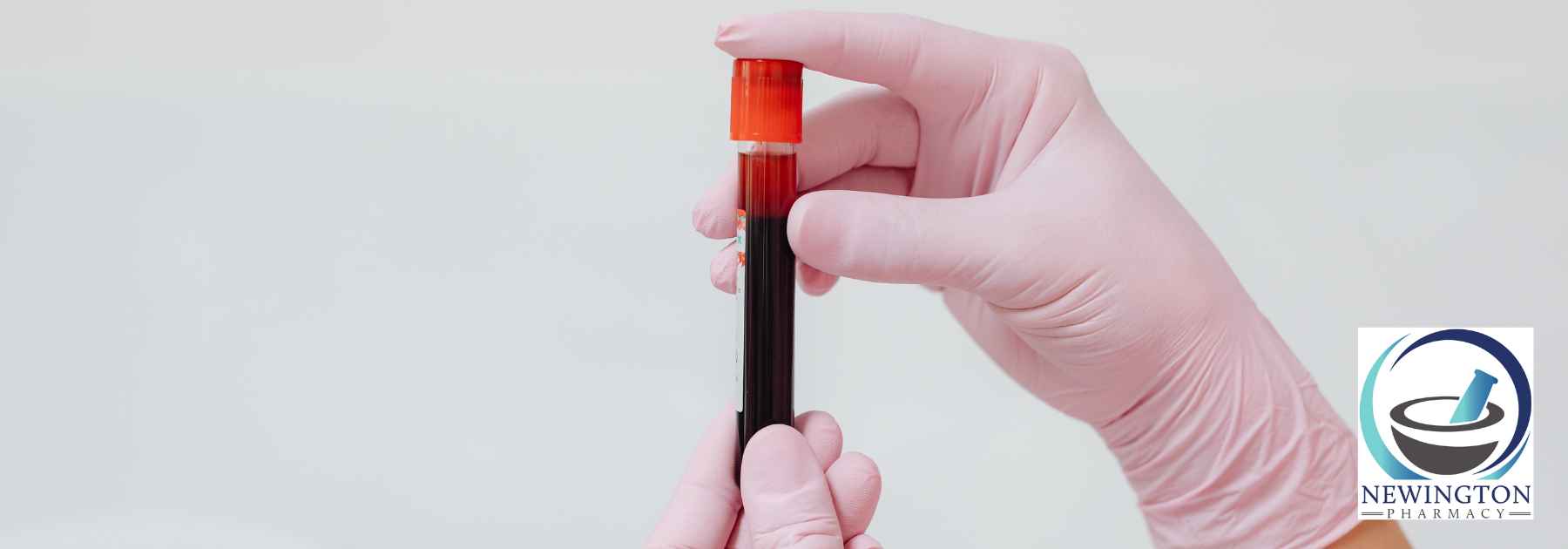 person wearing pink medical glove holding blood test