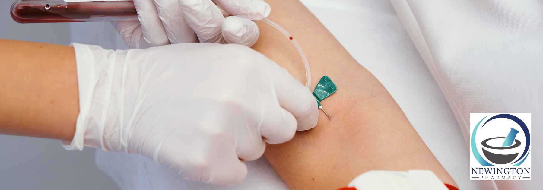 close-up of patient's arm during blood test appointment