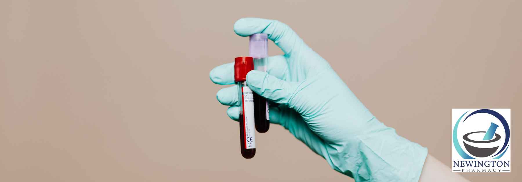 person wearing medical glove holding two blood tests on brown background